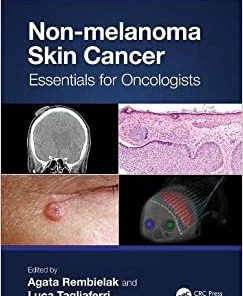 Non-melanoma Skin Cancer: Essentials for Oncologists