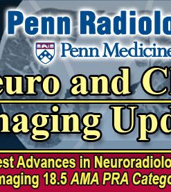 Penn Radiology Neuro and Chest Imaging Update 2023