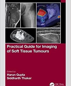 Practical Guide for Imaging of Soft Tissue Tumours ()