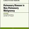 Pulmonary Complications of Non-Pulmonary Malignancy, An Issue of Clinics in Chest Medicine (Volume 38-2) (The Clinics: Internal Medicine, Volume 38-2)