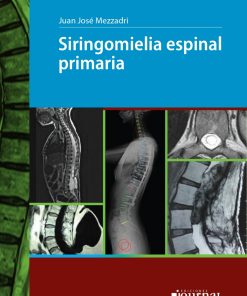 Siringomielia espinal primaria (High Quality Image PDF)
