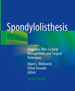 Spondylolisthesis, 2nd Edition