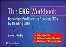 The EKG Workbook: Becoming Proficient in Reading EKGs by Reading EKGs ()