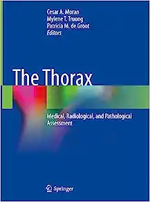 The Thorax: Medical, Radiological, and Pathological Assessment
