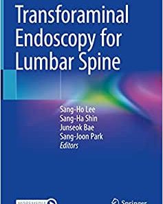 Transforaminal Endoscopy for Lumbar Spine ()
