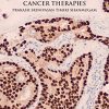 Understanding Cancer Therapies
