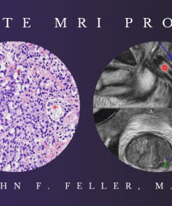 2021 Prostate MRI (Program 1) – John F. Feller, M.D
