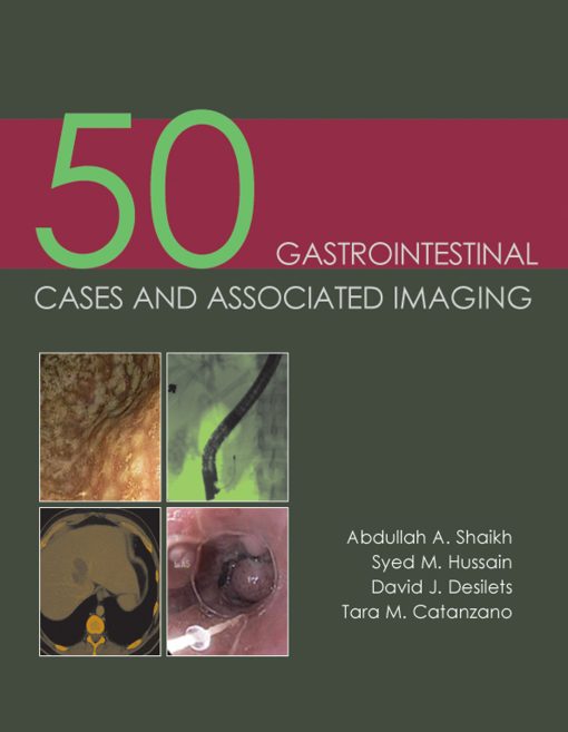 50 Gastrointestinal Cases and Associated Imaging ()