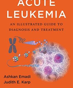 Acute Leukemia: An Illustrated Guide to Diagnosis and Treatment ()
