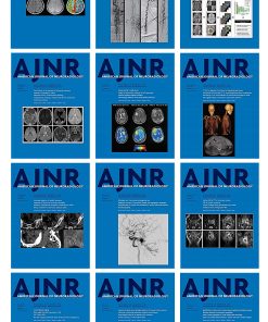 American journal of Neuroradiology 2022 Full Archives