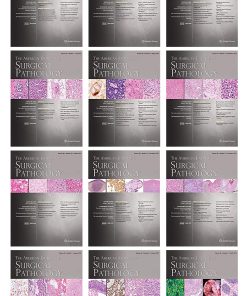 American Journal of Surgical Pathology 2022 Full Archives