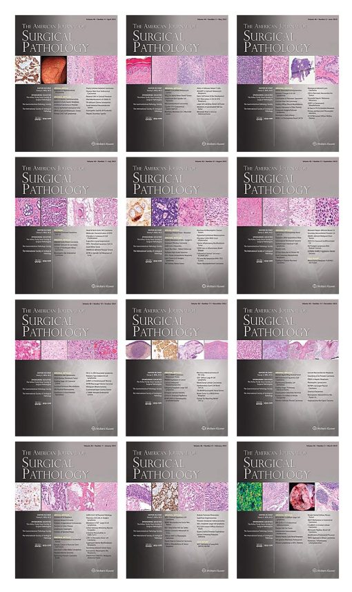 American Journal of Surgical Pathology 2022 Full Archives