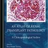 An Atlas of Renal Transplant Pathology
