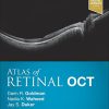 Atlas of Retinal OCT: Optical Coherence Tomography, 1e