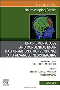 Brain Embryology and the Cause of Congenital Malformations, An Issue of Neuroimaging Clinics of North America (Volume 29-3) (The Clinics: Radiology, Volume 29-3)