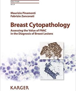 Breast Cytopathology: Assessing the Value of FNAC in the Diagnosis of Breast Lesions (Monographs in Clinical Cytology, Vol. 24)
