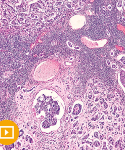 Breast Pathology 2023