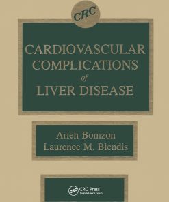 Cardiovascular Complications of Liver Disease