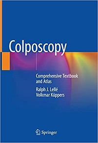 Colposcopy: Comprehensive Textbook and Atlas
