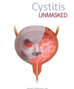 Cystitis unmasked