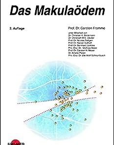 Das Makulaödem (UNI-MED Science) (German Edition), 2nd Edition
