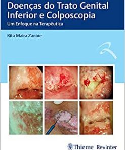 Doenças do Trato Genital Inferior e Colposcopia: Um Enfoque na Terapêutica