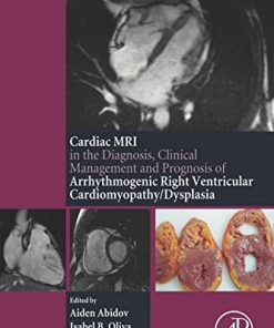 The Cardiac MRI in Diagnosis, Clinical Management, and Prognosis of Arrhythmogenic Right Ventricular Cardiomyopathy/Dysplasia