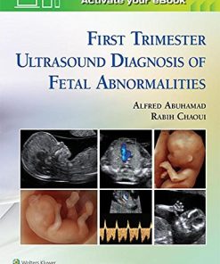 First Trimester Ultrasound Diagnosis of Fetal Abnormalities ()