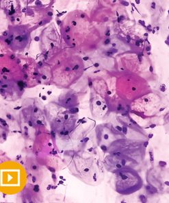 Gynecologic Pathology 2022