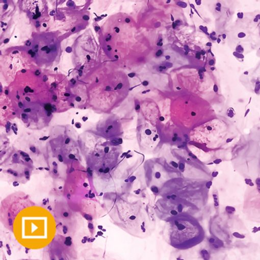 Gynecologic Pathology 2022