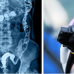 Harvard The Comprehensive 2023 Gastroenterology Update