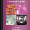 Hereditary and Familial Colorectal Cancer