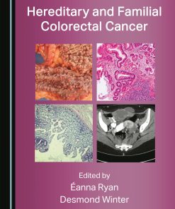 Hereditary and Familial Colorectal Cancer