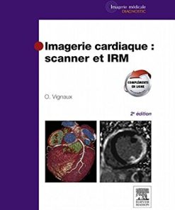Imagerie cardiaque: scanner et IRM, 2e