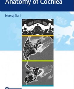 Imaging Handbook on Anatomy of Cochlea