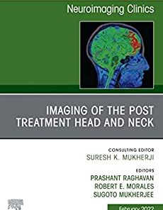 Imaging of the Post Treatment Head and Neck, An Issue of Neuroimaging Clinics of North America, E-Book (Clinics Collections)