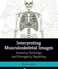 Interpreting Musculoskeletal Images: Anatomy, Pathology and Emergency Reporting