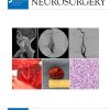 Journal of Neurosurgery 2023 Full Archives