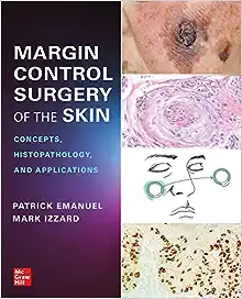 Margin Control Surgery of the Skin: Concepts, Histopathology, and Applications