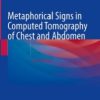 Metaphorical Signs in Computed Tomography of Chest and Abdomen, 2nd Edition