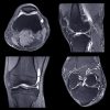 NYU Langone Advanced Imaging of the Musculoskeletal System: Up Your Game 2023
