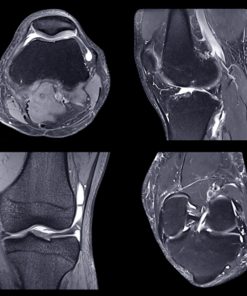 NYU Langone Advanced Imaging of the Musculoskeletal System: Up Your Game 2023