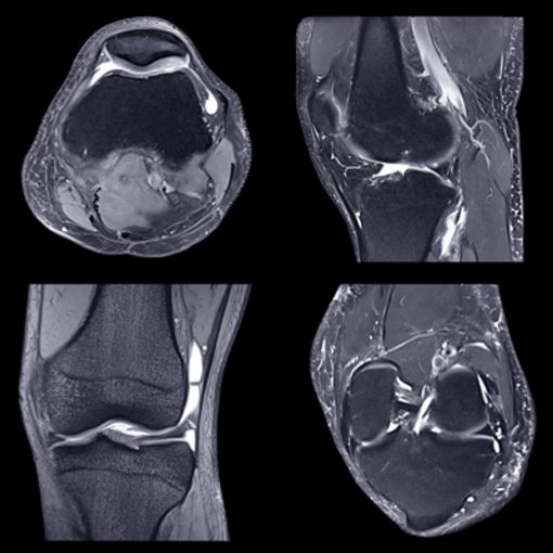 NYU Langone Advanced Imaging of the Musculoskeletal System: Up Your Game 2023