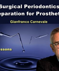 OHI-S Surgical periodontics: preparation for prosthetics