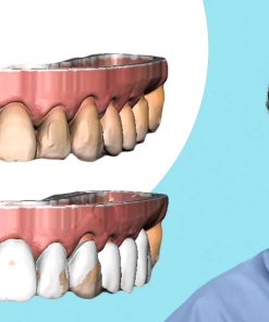 OHI-S The Complete Guide To Digital Dentistry