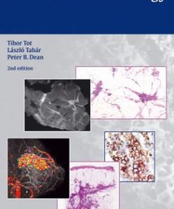 Practical Breast Pathology, 2nd Edition