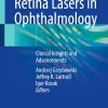 Retina Lasers in Ophthalmology