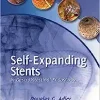 Self-Expanding Stents in Gastrointestinal Endoscopy