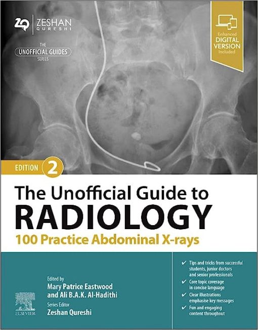 The Unofficial Guide to Radiology: 100 Practice Abdominal X-rays, 2nd edition