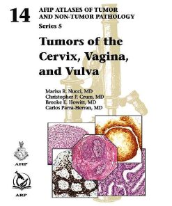 Tumors of the Cervix, Vagina, and Vulva (AFIP Atlas of Tumor Pathology, Series 5)